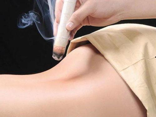 艾灸腰部视频,缓解腰痛，养生保健的神奇疗法