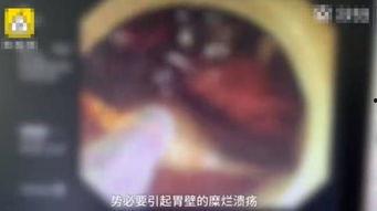 腹痛难忍视频,揭秘突发剧烈腹痛背后的真相