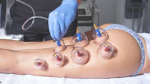 全身拔罐减肥视频,轻松塑形，焕发健康光彩